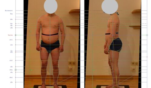 Durchführung eines Patientenscreenings mit digitaler Maßabnahme. (Foto: DITF)
