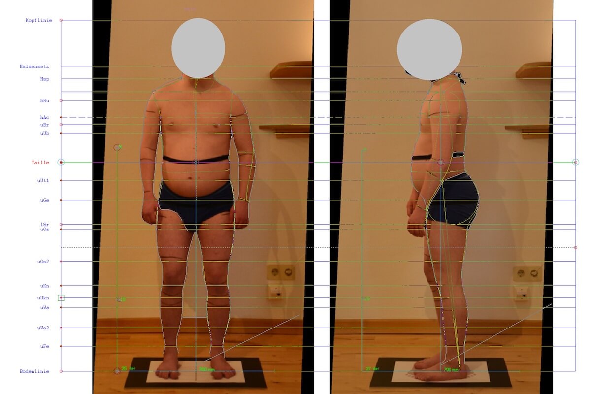 Durchführung eines Patientenscreenings mit digitaler Maßabnahme. (Foto: DITF)