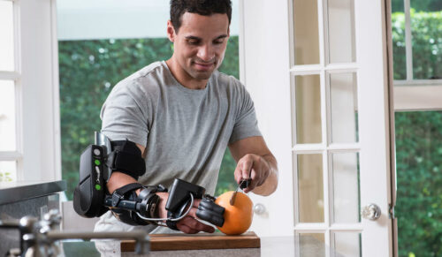 Die MyoPro Orthese wird durch zertifizierte Orthopädietechniker bereitgestellt. (Foto: Myomo)