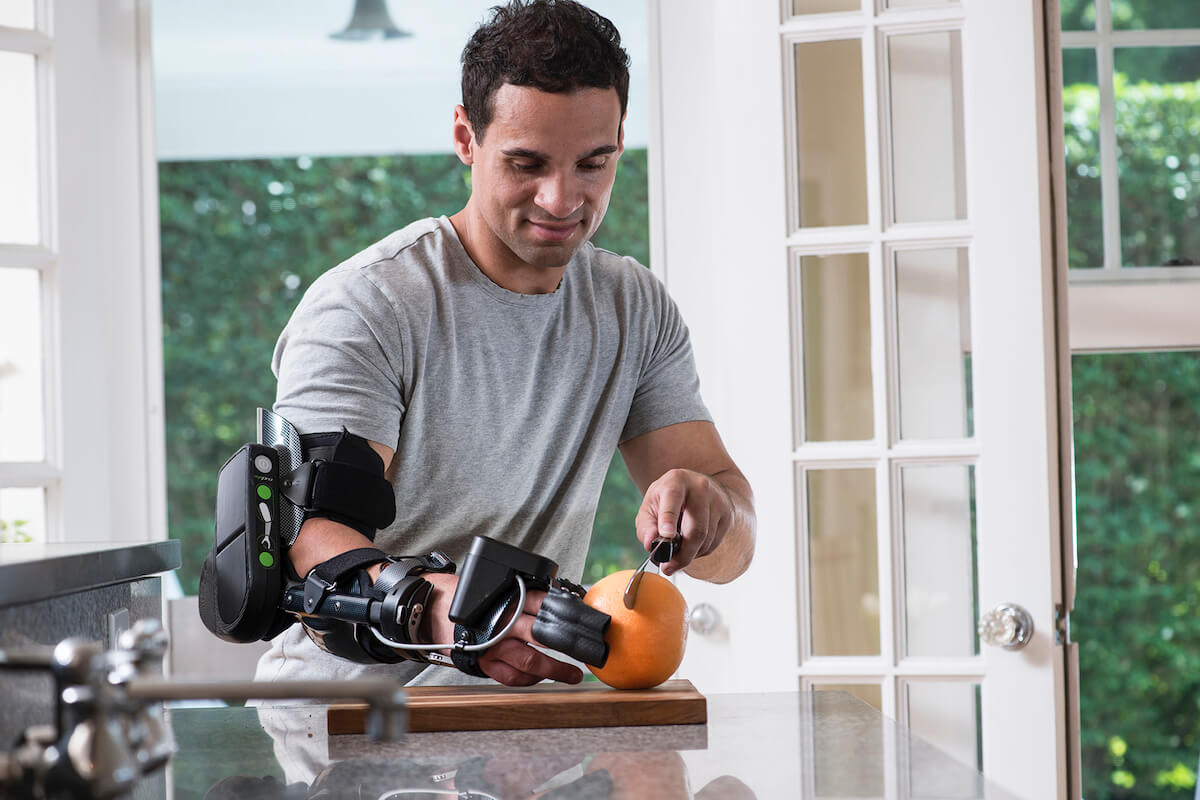 Die MyoPro Orthese wird durch zertifizierte Orthopädietechniker bereitgestellt. (Foto: Myomo)