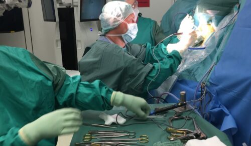 Das Exoskelett Paexo Shoulder – unter der OP-Kleidung – entlastet Schulter- und Armmuskulatur von Prof. Dr. Veit Rohde bei längeren neurochirurgischen Operationen. (Foto: Neurochirurgische Klinik Universitätsmedizin Göttingen/NCHI)