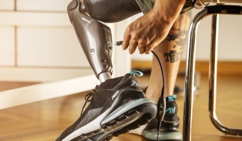 Das neue C-Leg. (Foto: Ottobock)