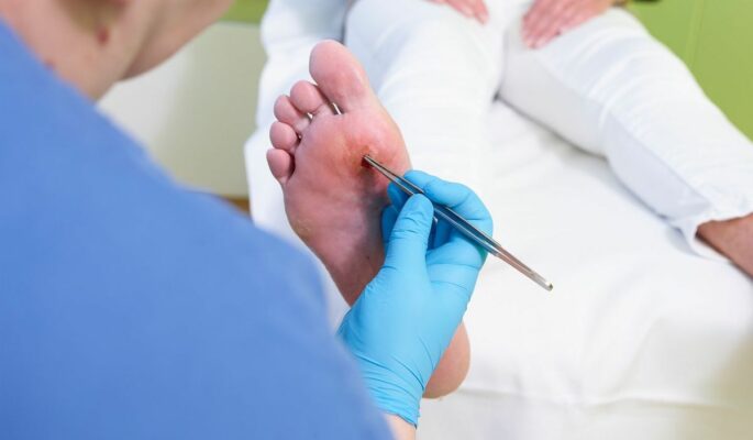 Versorgung beim Diabetischen Fußsyndrom (Foto: BVMed)